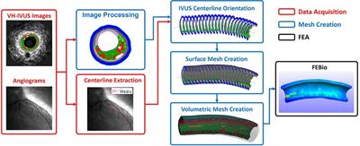 Automated finite element approach to generate anatomical patient-specific biomechanical models of atherosclerotic arteries from virtual histology-intravascular ultrasound